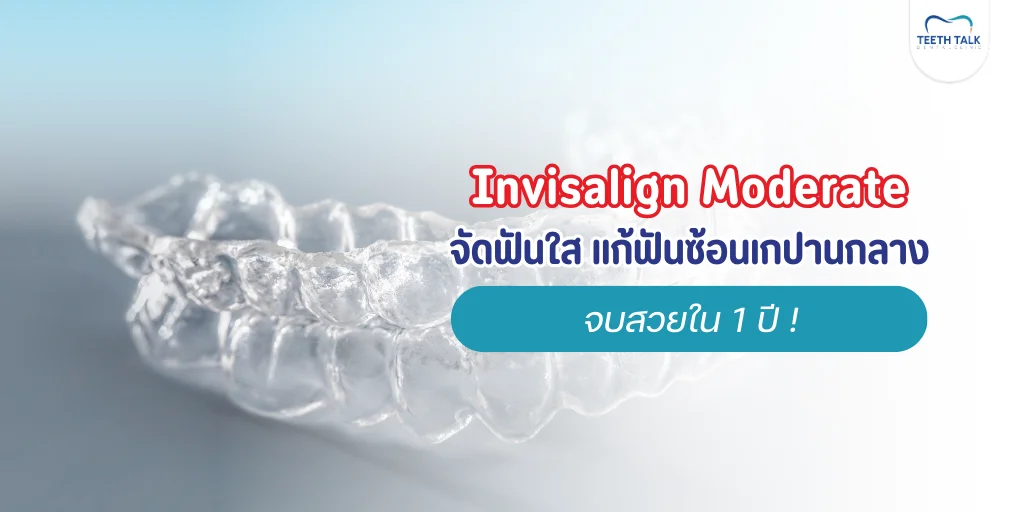 Invisalign Moderate