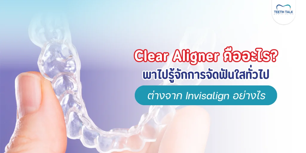 Clear Aligner คืออะไร