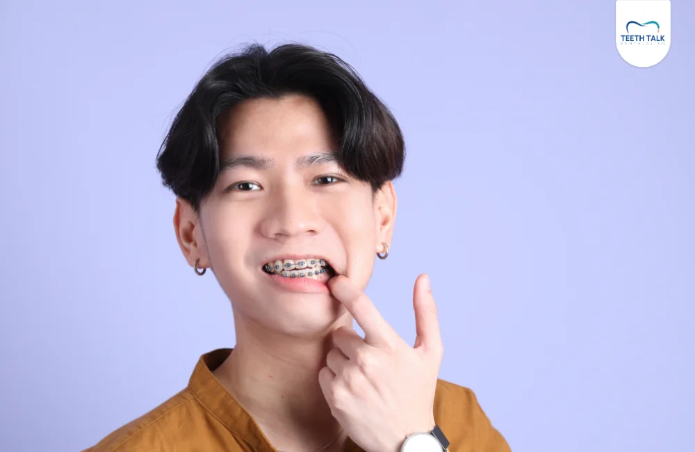 ลวดเหล็กดัดฟันหลุด