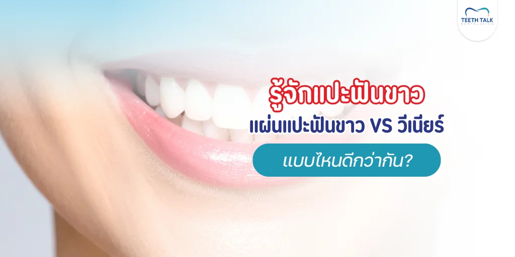 แปะฟันขาวคืออะไร)