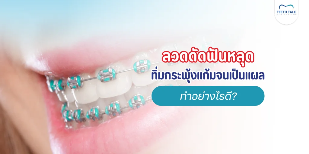 ลวดดัดฟันหลุด ทิ่มกระพุ้งแก้ม