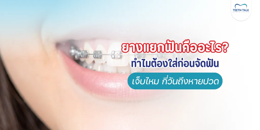 ยางแยกฟันคืออะไร