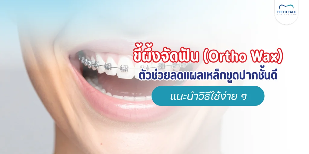 ขี้ผึ้งจัดฟัน Ortho Wax