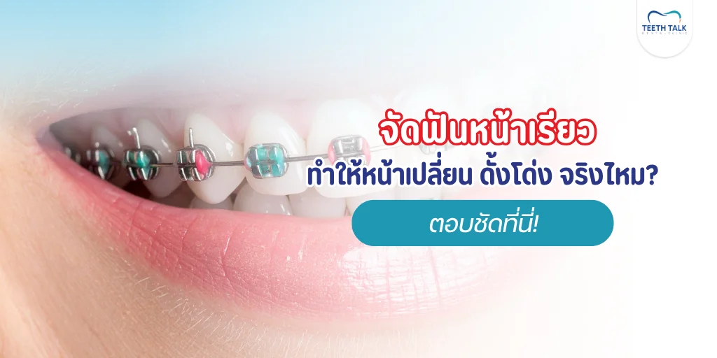 : จัดฟันหน้าเรียวจริงไหม