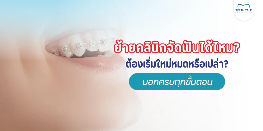 ย้ายคลินิกจัดฟันได้ไหม