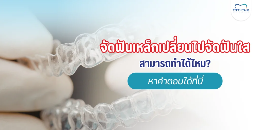จัดฟันเหล็ก เปลี่ยนเป็นจัดฟันใส