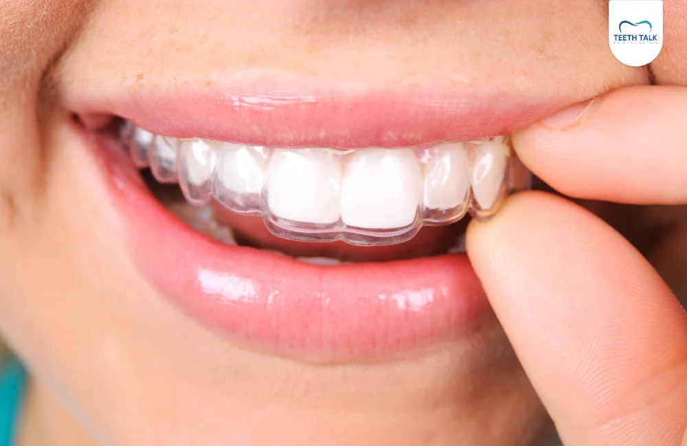 ทำรีเทนเนอร์ จัดฟันรอบสอง ที่ TEETH TALK DENTAL CLINIC