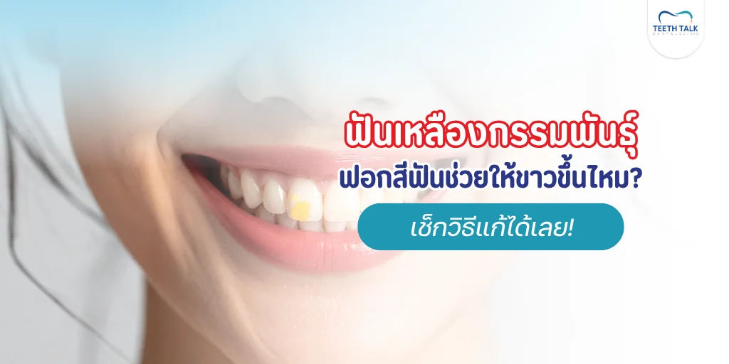 ฟันเหลืองกรรมพันธุ์