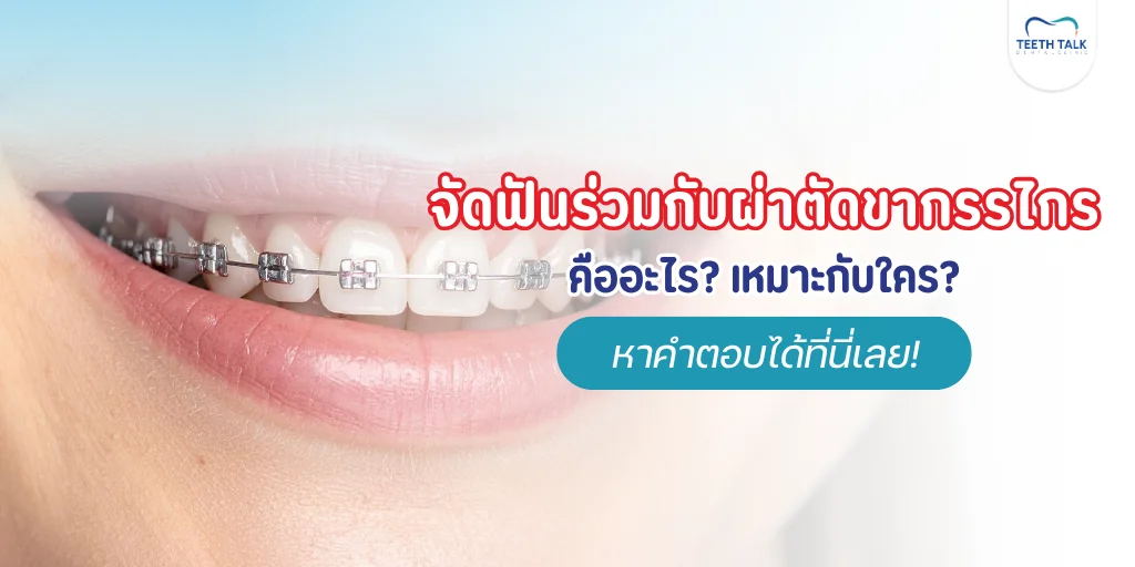 จัดฟันร่วมกับผ่าตัดขากรรไกร