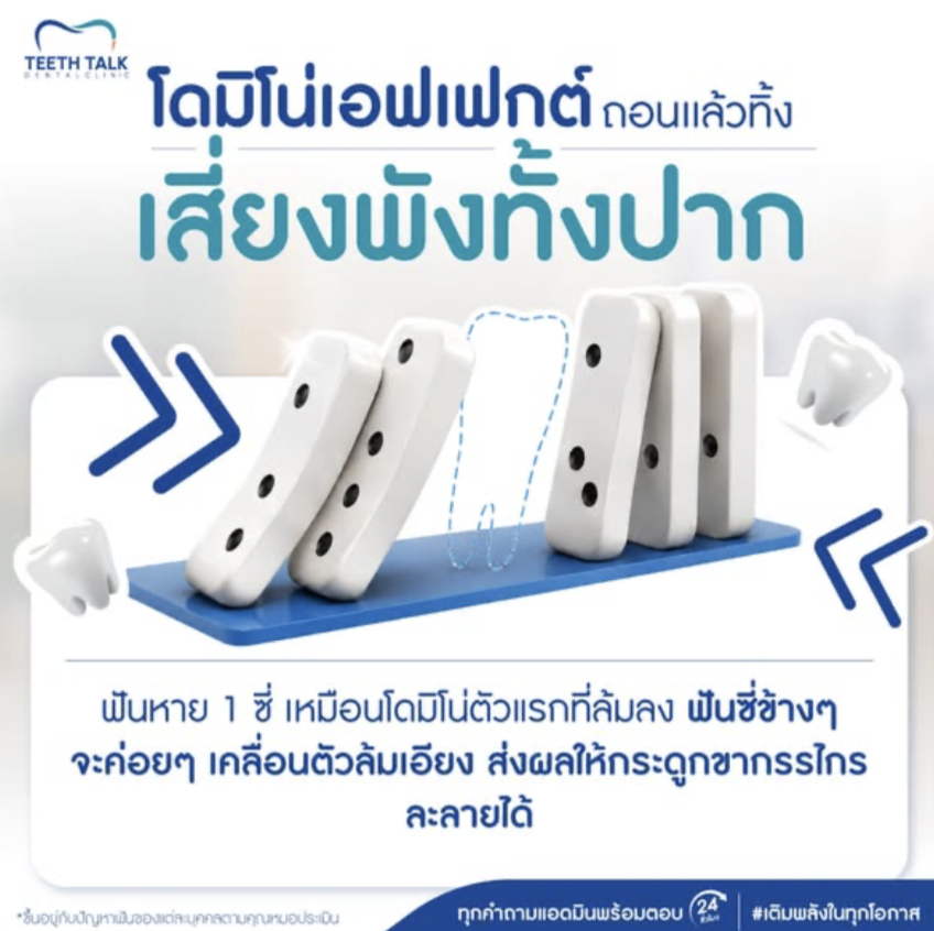 รากฟันเทียม เริ่มต้นงวดแรกเพียง 3,999.- ไม่ต้องใช้บัตรเครดิต ฟรี CT Scan 3 มิติ
