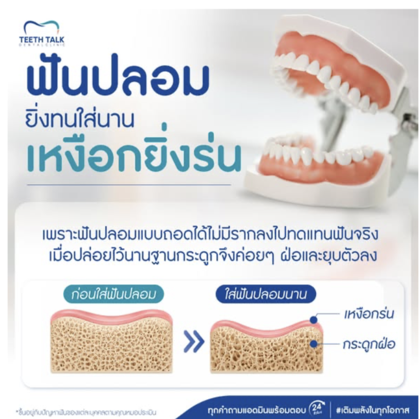 รากฟันเทียม เริ่มต้นงวดแรกเพียง 3,999.- ไม่ต้องใช้บัตรเครดิต ฟรี CT Scan 3 มิติ