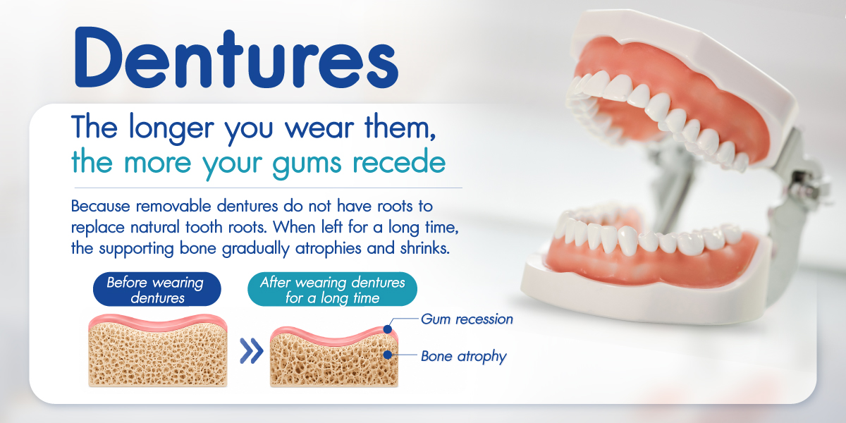 Dental implants: Initial payment starts at just 3,999 Baht. No credit card required. Free 3D CT scan included.