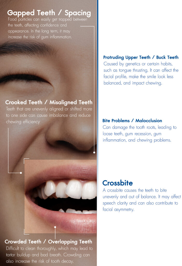 Metal Braces Promotion Starting from THB 999/month FREE! 8 Exclusive Benefits