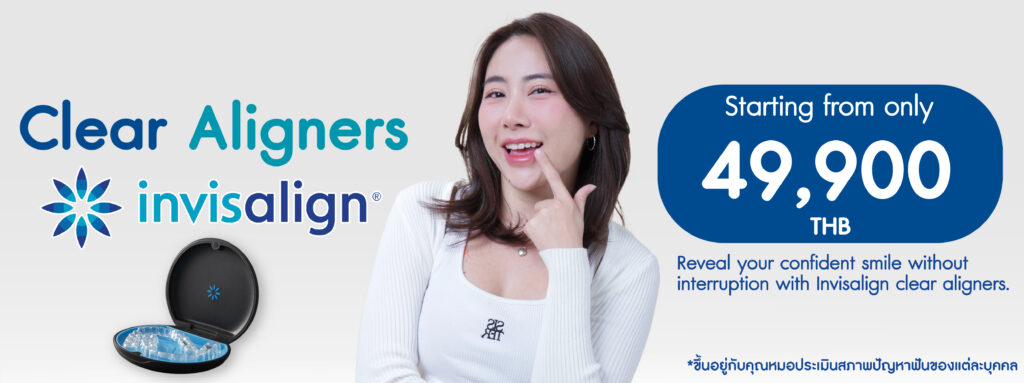Invisalign Promotion 0% Installment Plan No Credit Card RequiredFree Consultation
