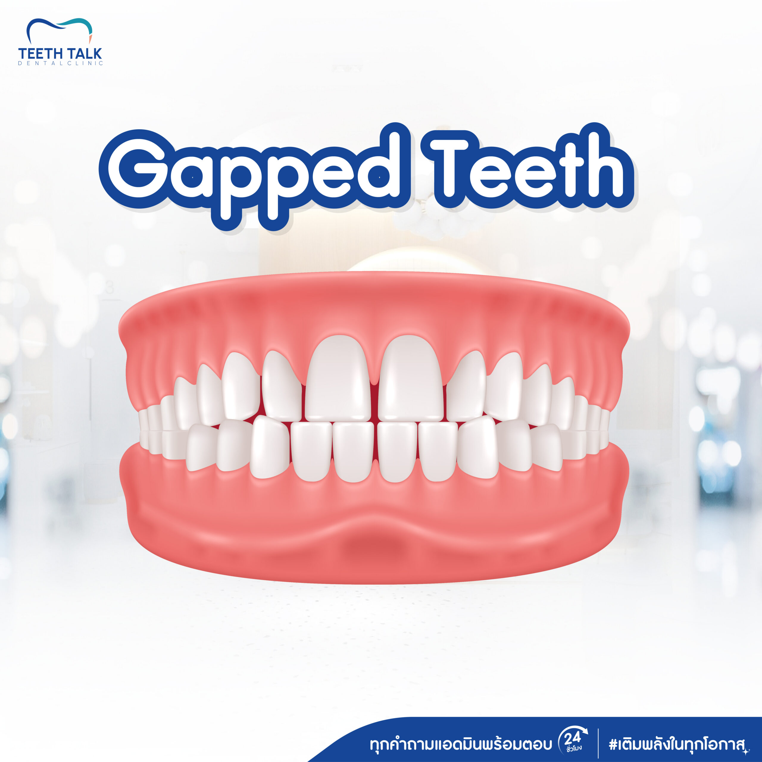 Invisalign Promotion 0% Installment Plan No Credit Card RequiredFree Consultation