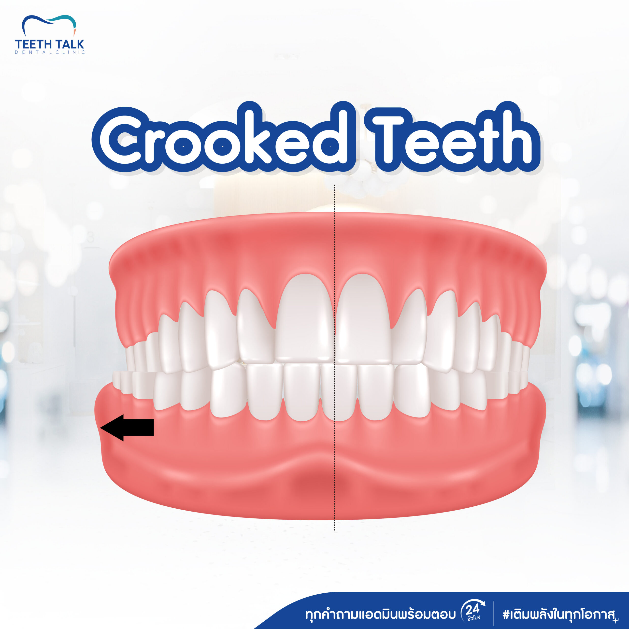 Invisalign Promotion 0% Installment Plan No Credit Card RequiredFree Consultation