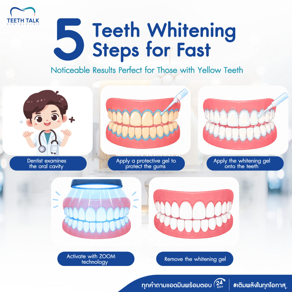 Professional Teeth Whitening Visible Results in Just 45 MinutesFREE Dental ScalingSave Up to THB 7,000