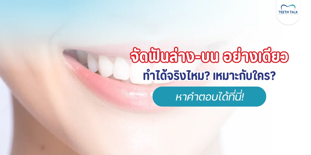 จัดฟันล่างอย่างเดียว จัดฟันบนอย่างเดียว