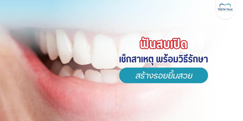 ฟันสบเปิดทำไงดี