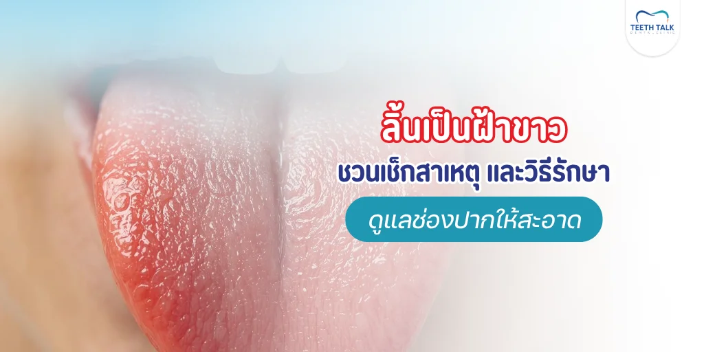ลิ้นเป็นฝ้าขาวทำไงดี