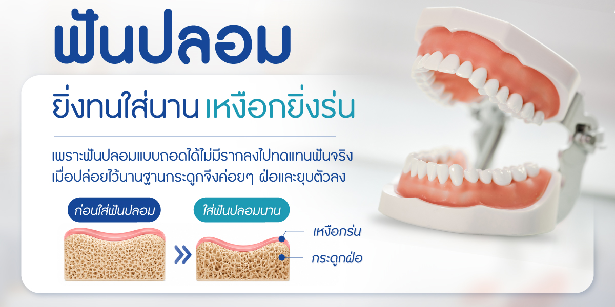 รากฟันเทียม เริ่มต้นงวดแรกเพียง 3,999.- ไม่ต้องใช้บัตรเครดิต ฟรี CT Scan 3 มิติ