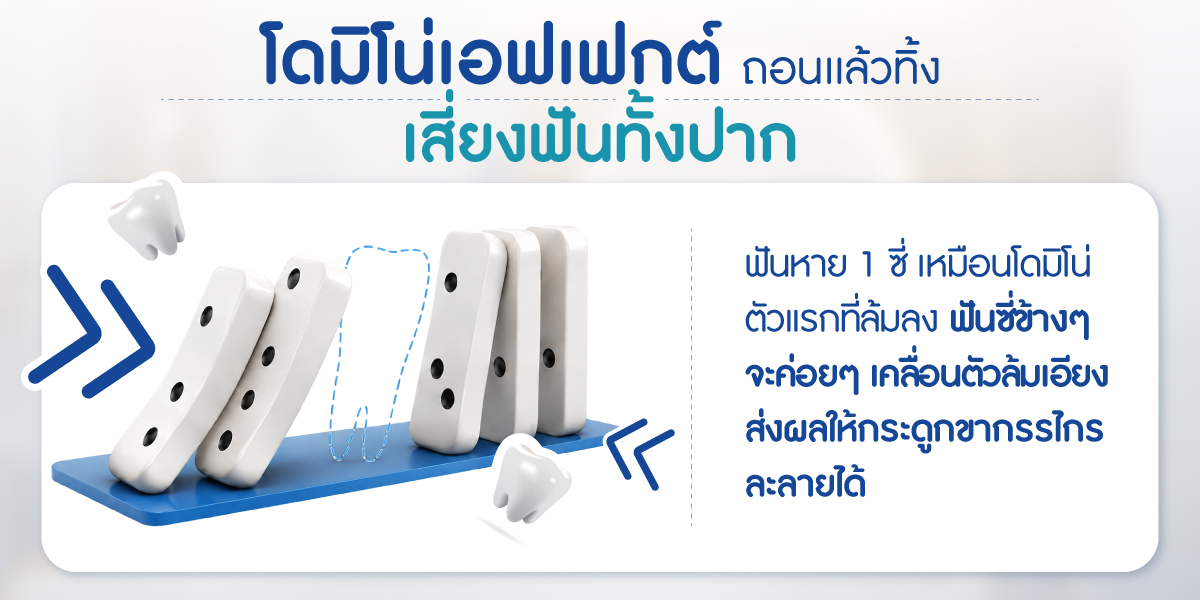 รากฟันเทียม เริ่มต้นงวดแรกเพียง 3,999.- ไม่ต้องใช้บัตรเครดิต ฟรี CT Scan 3 มิติ