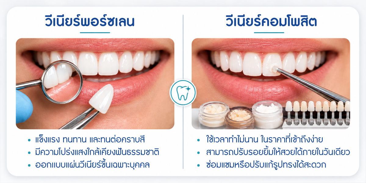 วีเนียร์ เปลี่ยนรอยยิ้มใหม่ เริ่มต้น 2,250.-/ซี่ ผ่อน 0% สูงสุด 3 เดือน